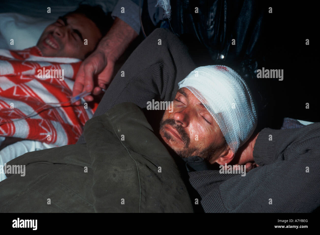 Shrapnel wound hires stock photography and images Alamy