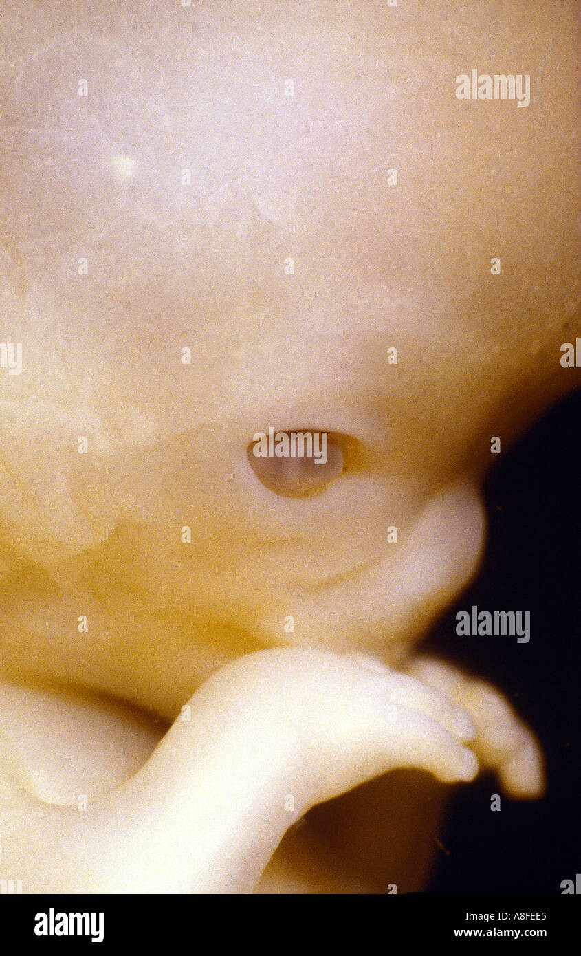 Fetus 7 weeks Stock Photo