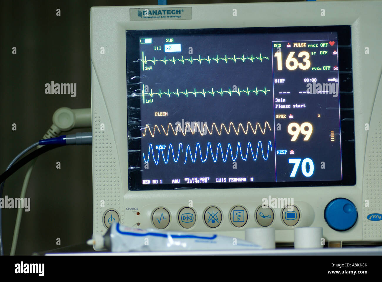 Control monitor of the anaesthesist during a surgery Stock Photo