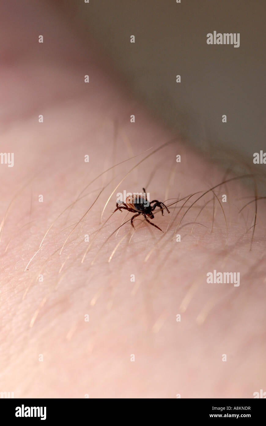 Tick (Ixodida) crawling on skin Stock Photo