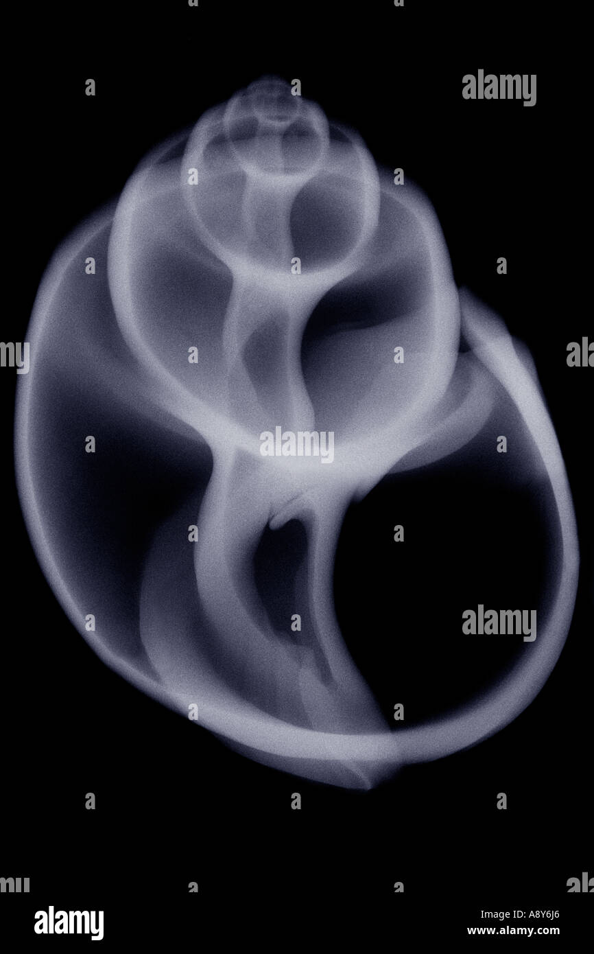 X-ray photograph of a shell: the Babylonia spirata.  Radiographie d'un coquillage: le Babylonia spirata. Image noir et blanc. Stock Photo