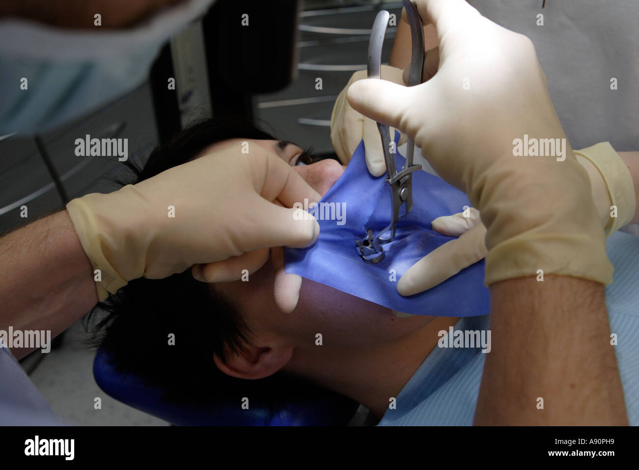 Dental treatment with a cofferdam - Behandlung mit Kofferdamm beim Zahnarzt Stock Photo