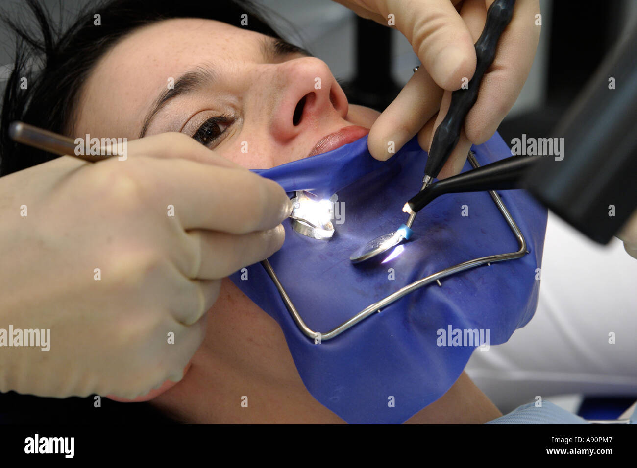 Dental treatment with a cofferdam - Behandlung mit Kofferdamm beim Zahnarzt Stock Photo