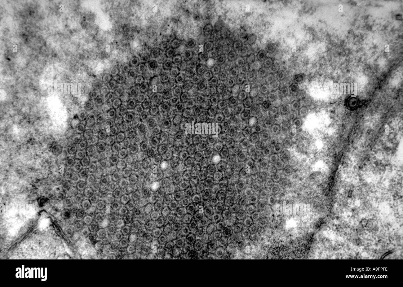 Photomicrograph herpes simplex x73000 Stock Photo - Alamy