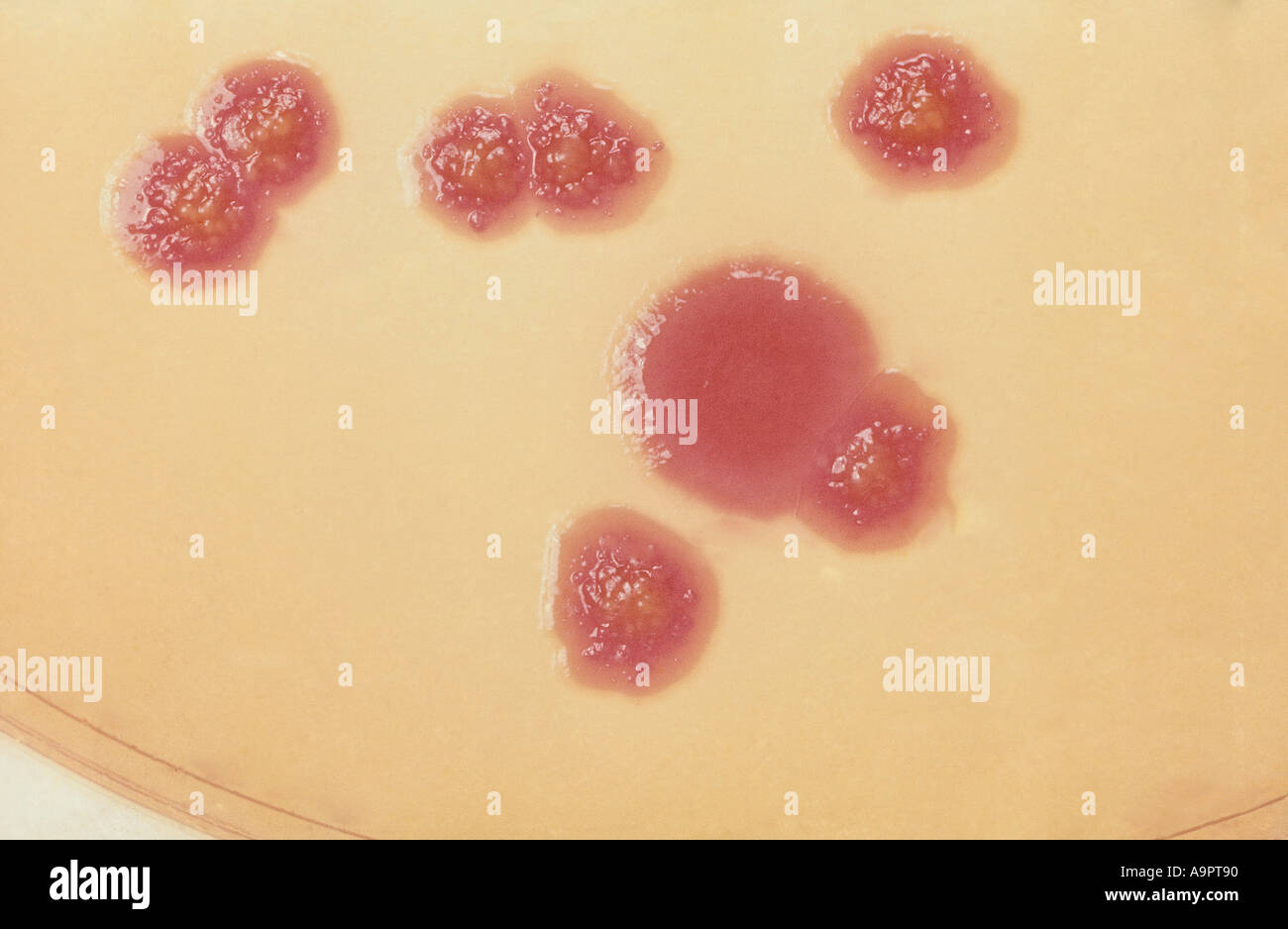 Escherichia coli Stock Photo