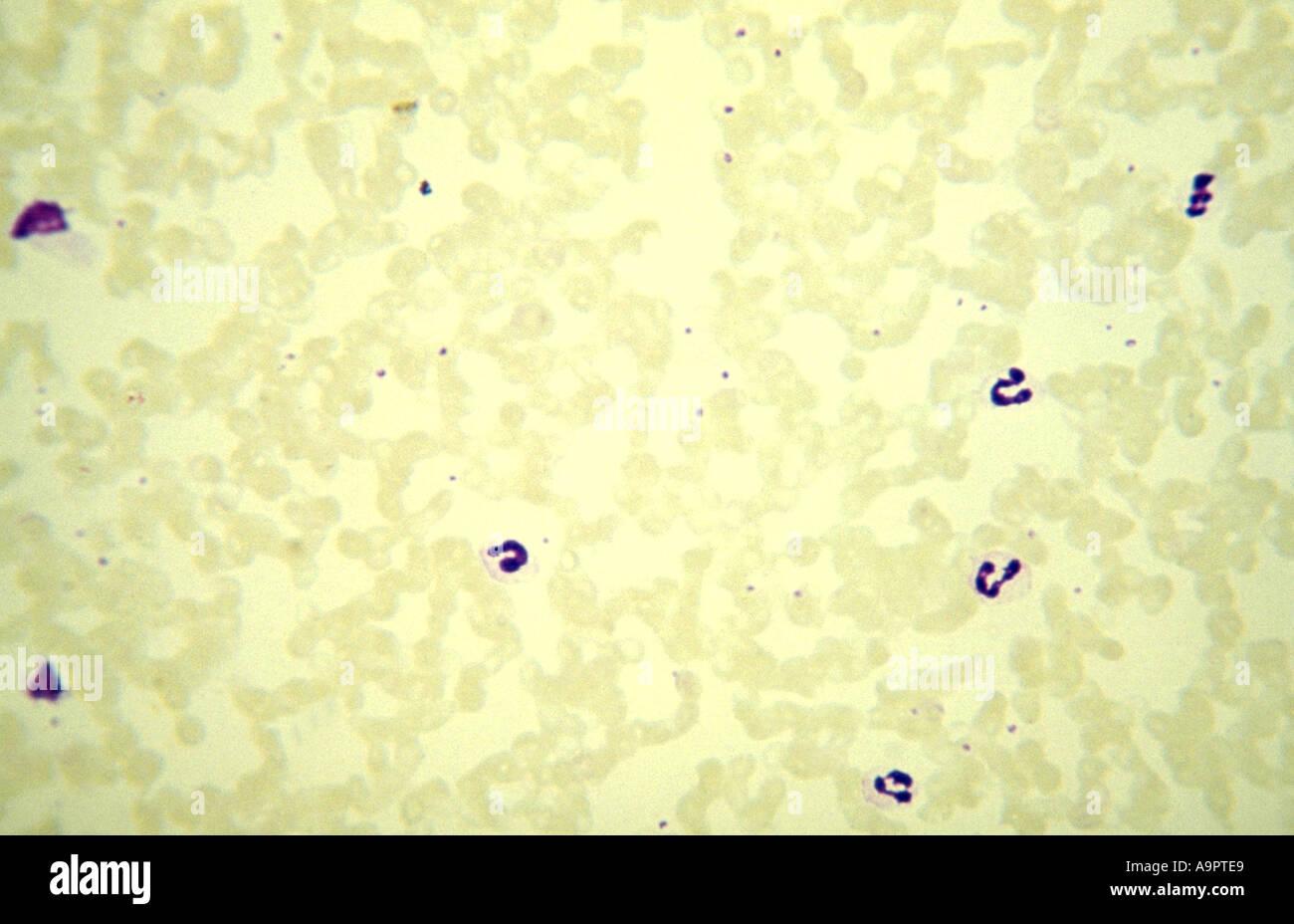 Photomicrograph plasmodium malariae Stock Photo