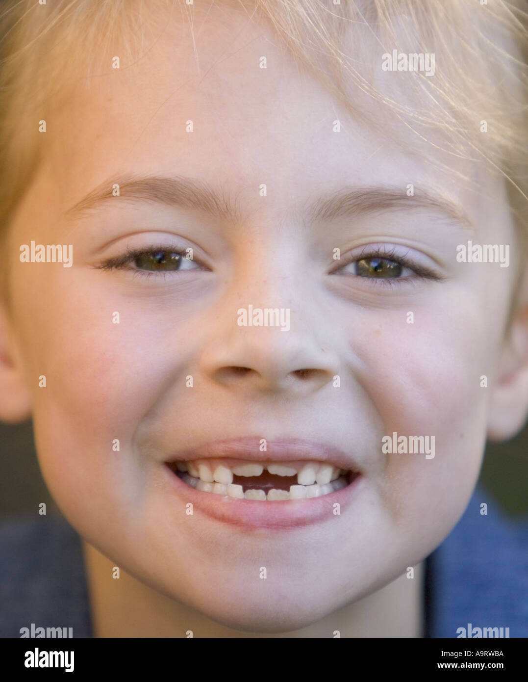Child smiling with missing teeth Stock Photo