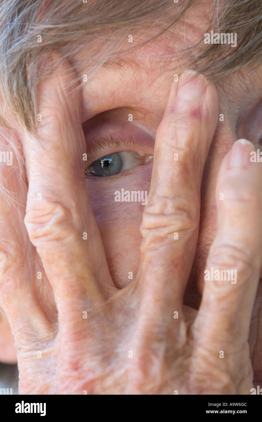 arthritic wrinkled hands of old woman hiding face Alzheimer Stock Photo