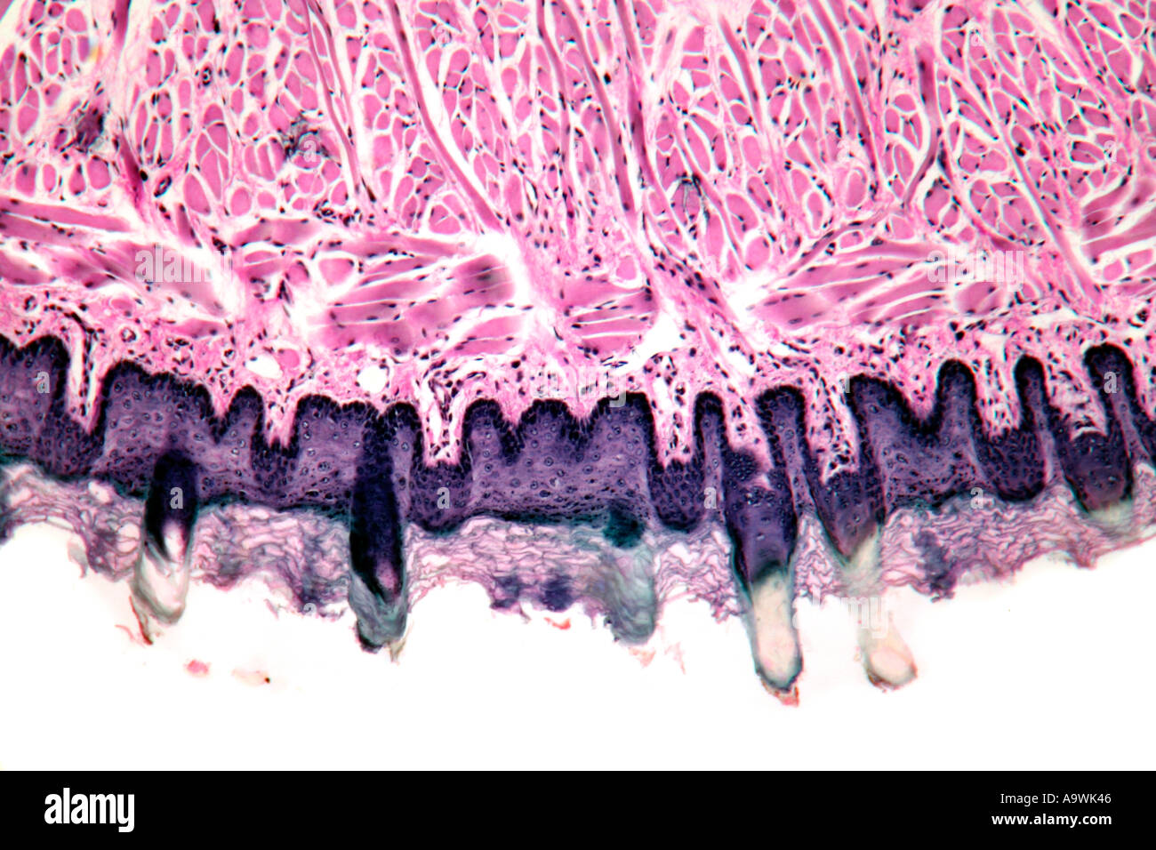 skeletal muscle tongue stained photomicrograph Stock Photo