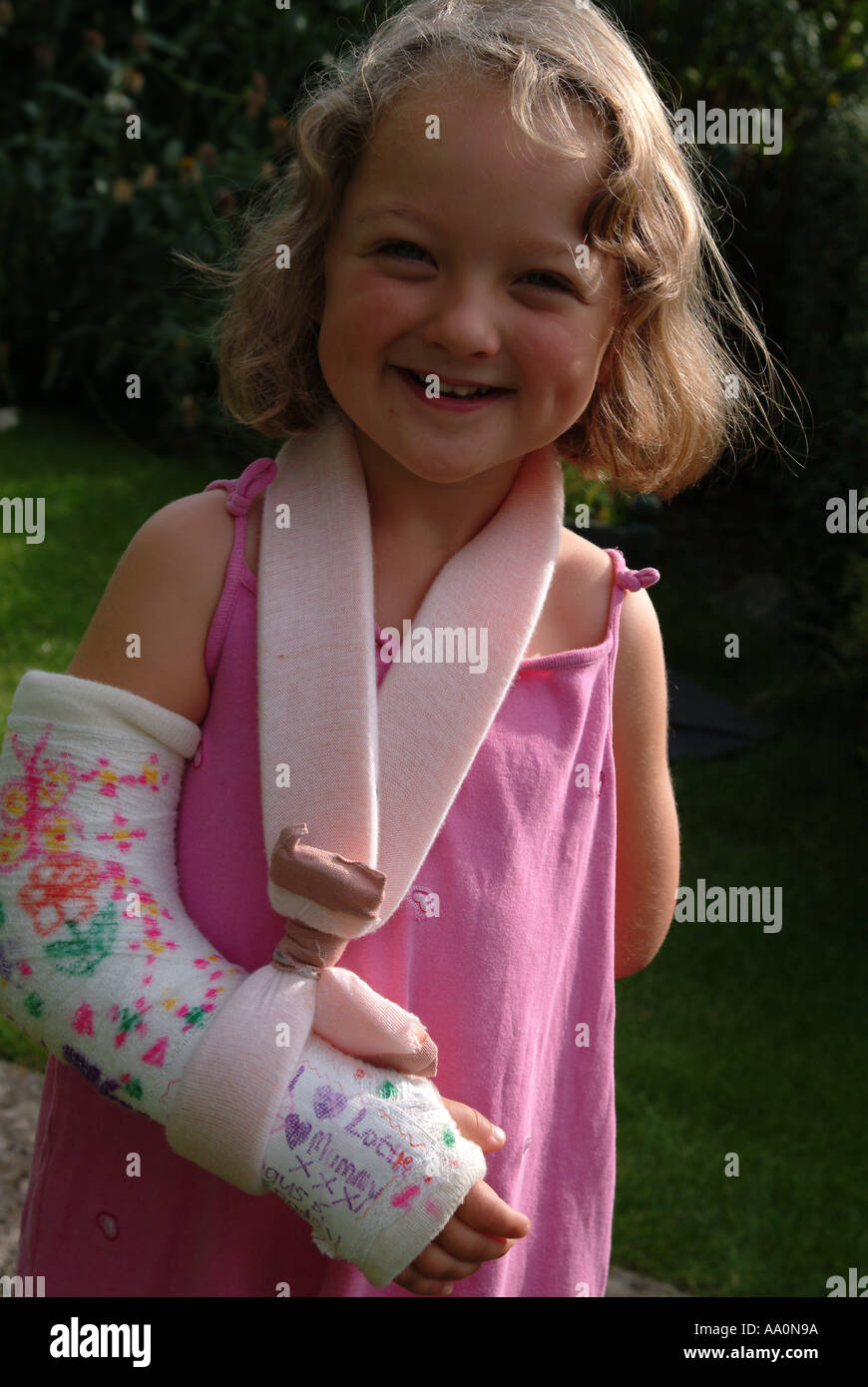Portrait of a little girl with a broken arm Stock Photo Alamy