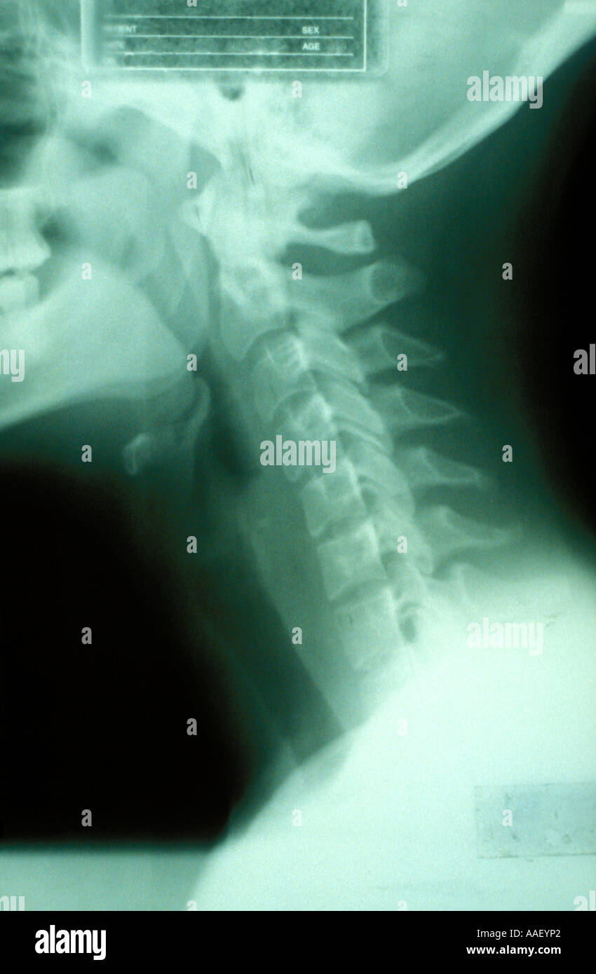 Patientpicture hires stock photography and images Alamy