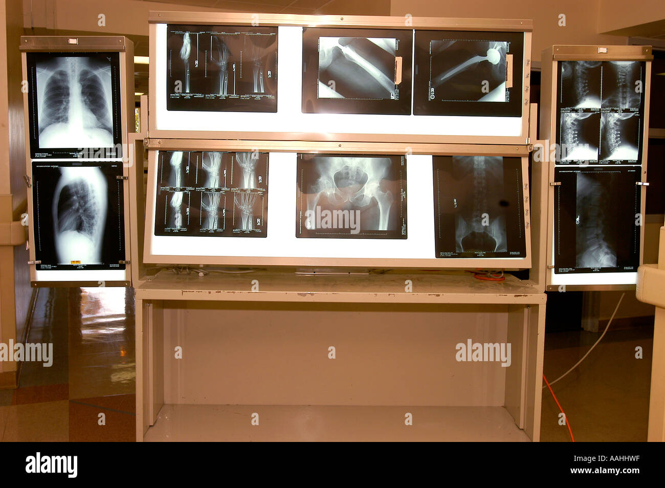 A US medical hospital bone clinic light board displaying various