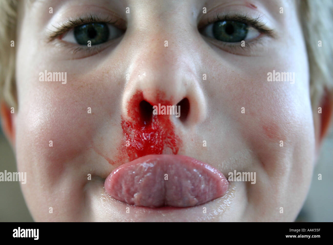 boy with bloody nose Stock Photo