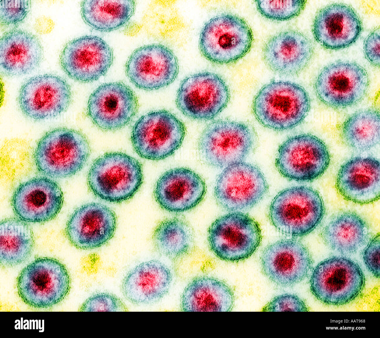 HIV 1 AIDS transmission electron micrograph virus particles Stock Photo ...