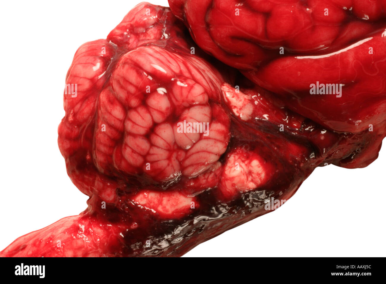 Brain Stock Photo