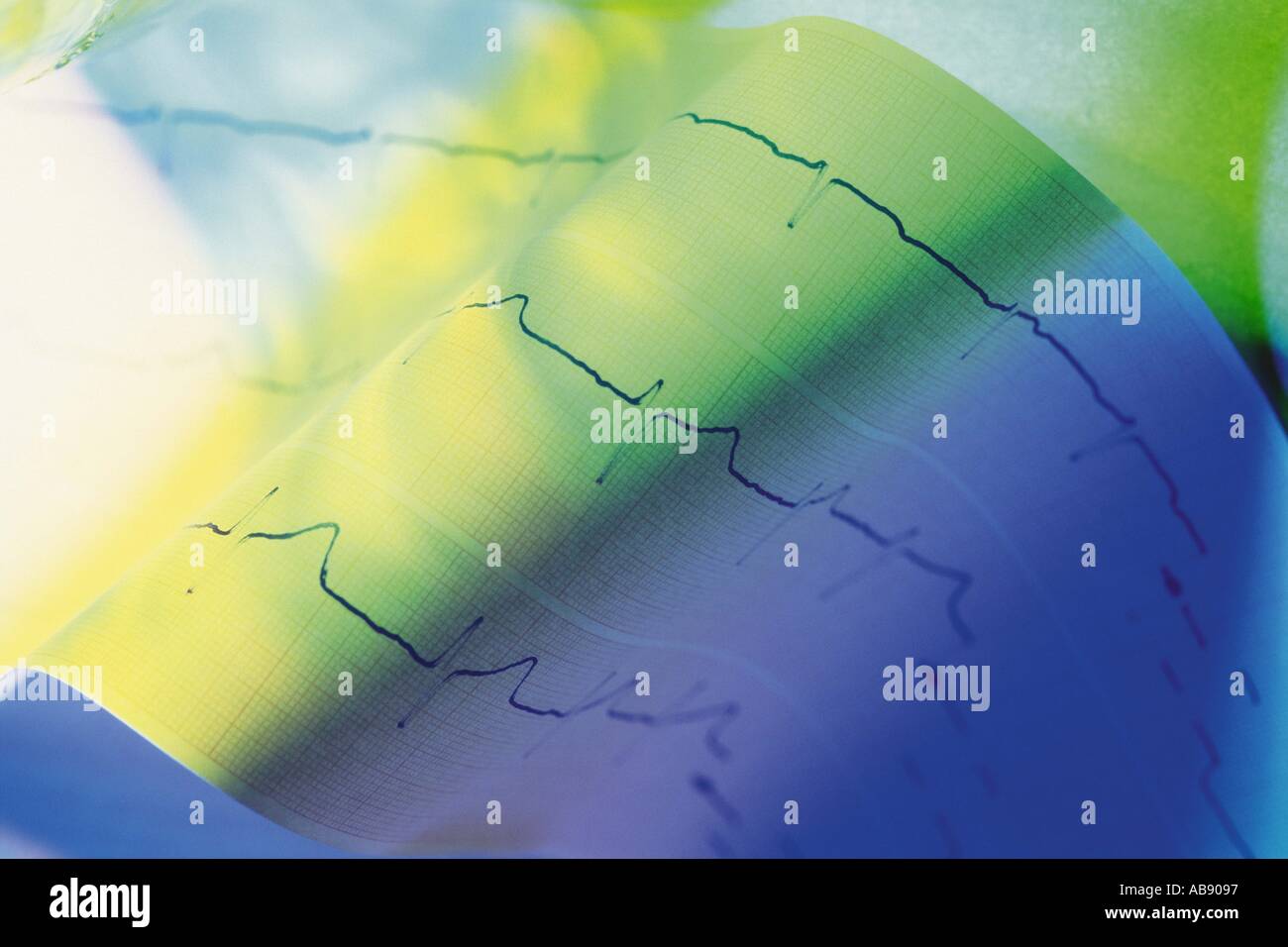 Ecg chart hi-res stock photography and images - Alamy