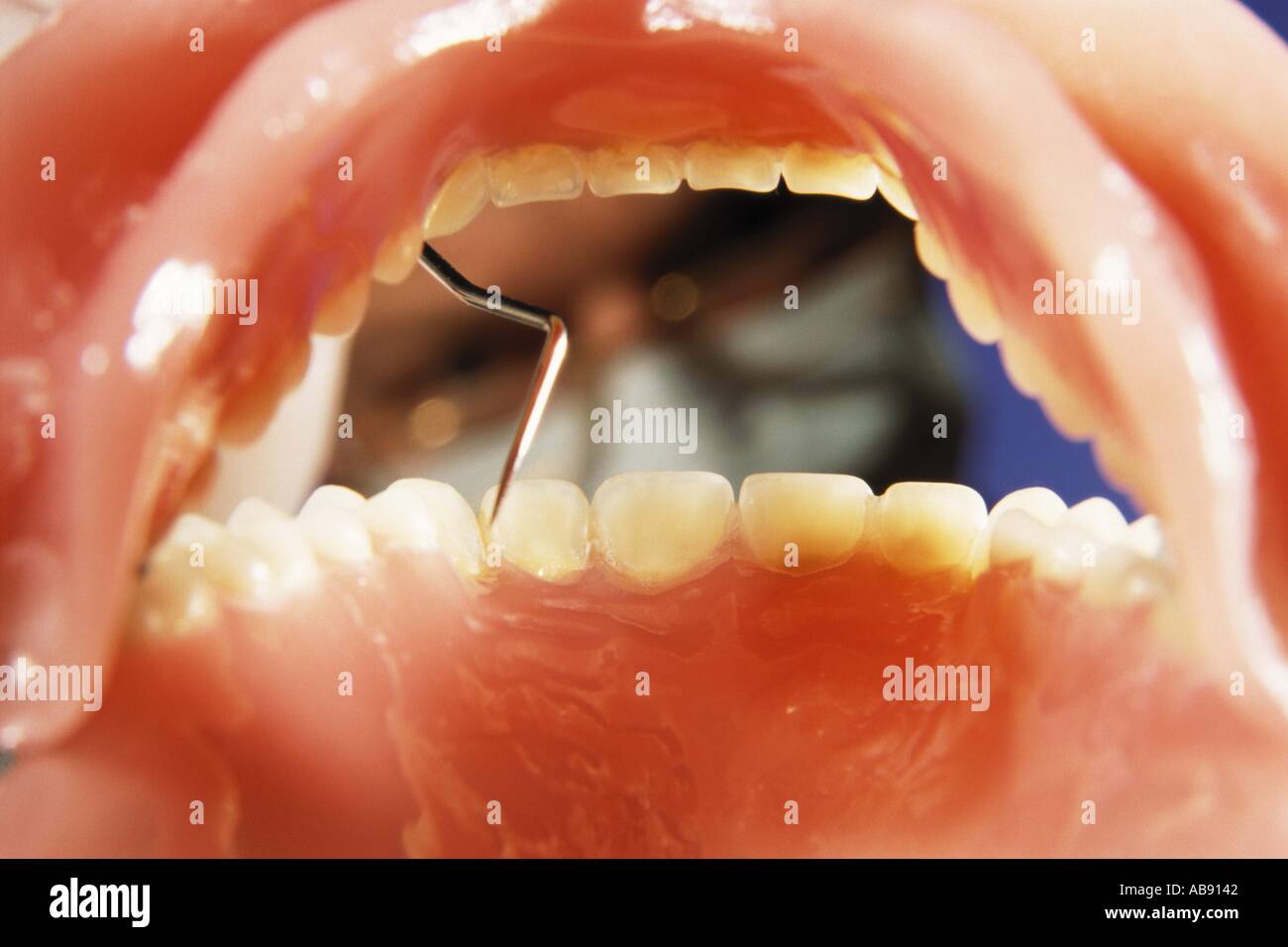 Зубы у детей сроки прорезывания молочных зубов. Очерёдность прорезывания зубов у детей до года. Зубы у детей 6 лет порядок прорезывания. Сроки прорезывания первых молочных зубов. Схема прорезывания коренных зубов.