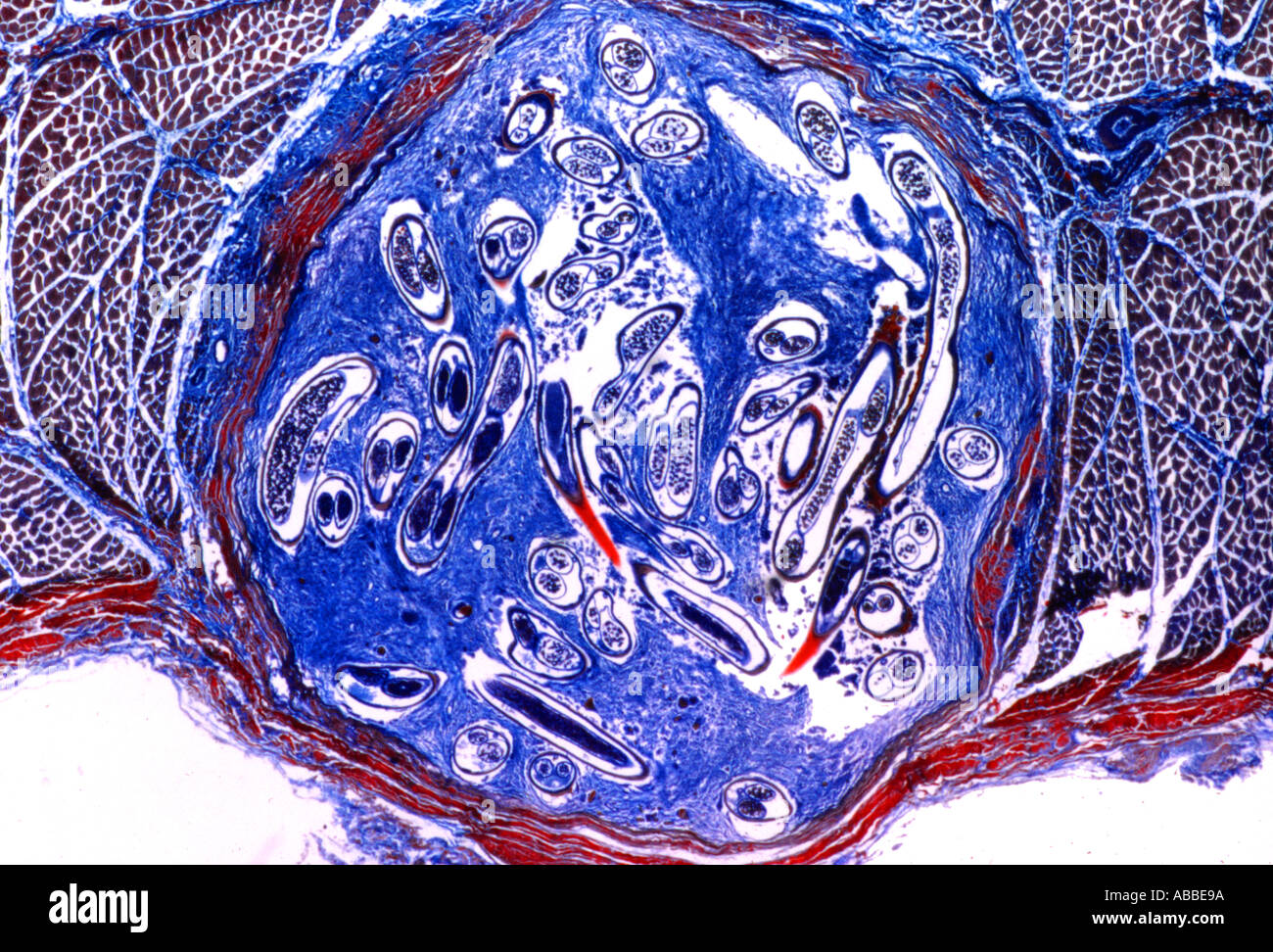 Section thru hydatid cyst of tapeworm Echinococcus granulosus Stock Photo