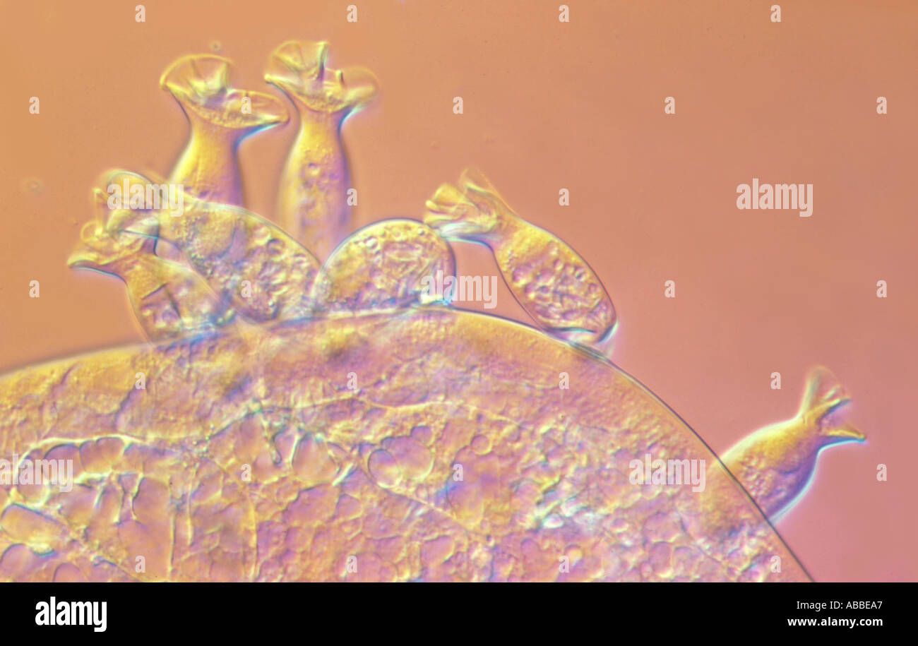 The Ciliate Protozoan Spirochona ambiguum on gill cover of Gammarus Living Nomarski DIC Flash HFW 700um Stock Photo
