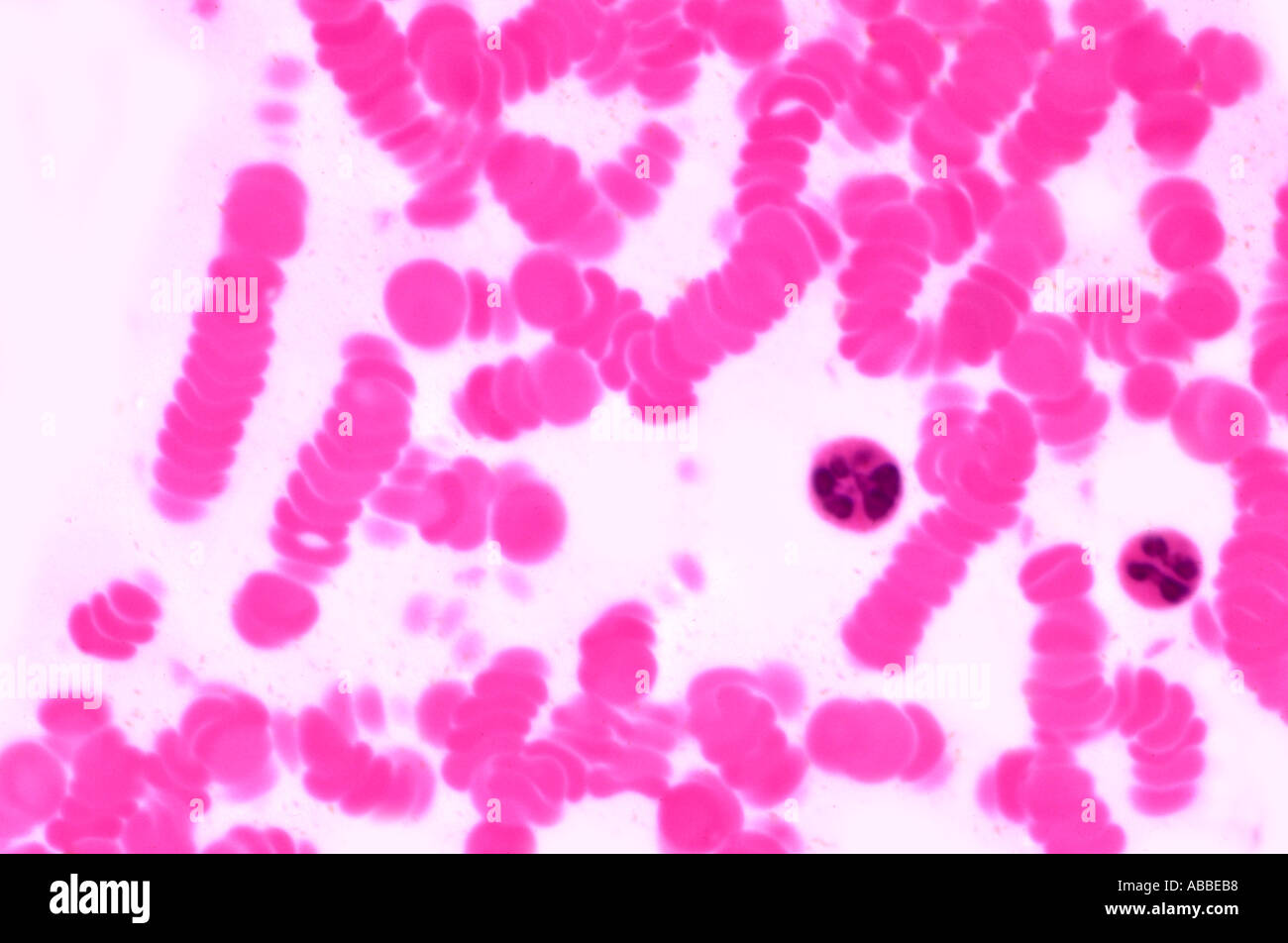 Human peripheral blood Semithin section of rouleaux of red cells