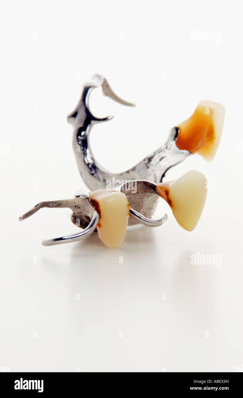 Traditional dental plate with three teeth Stock Photo Alamy