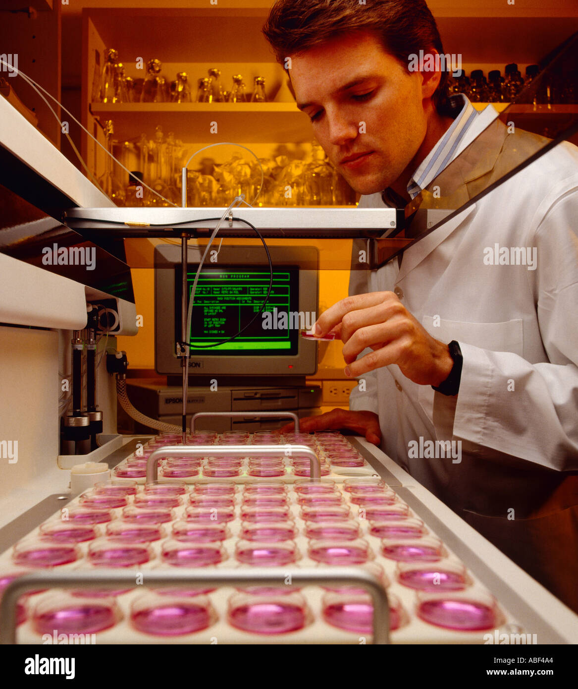 Laboratory - Medical Genetics, Amniocentesis cell harvest for chromosome analysis / USA. Stock Photo