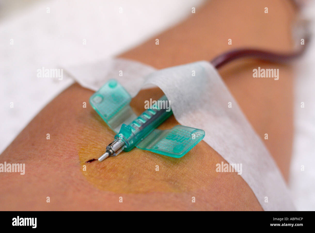 needle in arm, blood donation Stock Photo Alamy