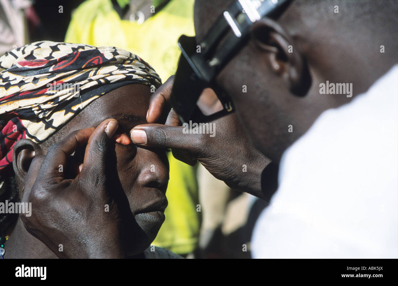 A doctor checks for the eye disease Trachoma in the Pays Dogon, Mali, West Africa Stock Photo
