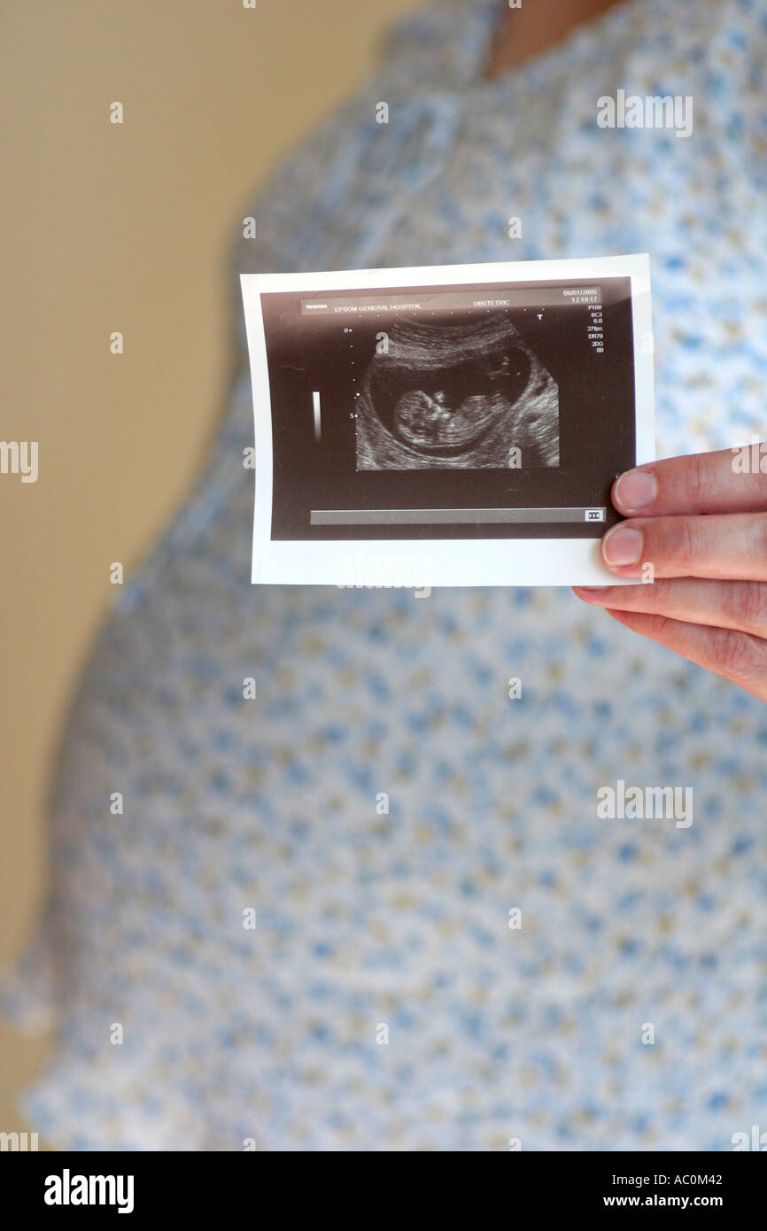 pregnant woman showing scan of baby Stock Photo