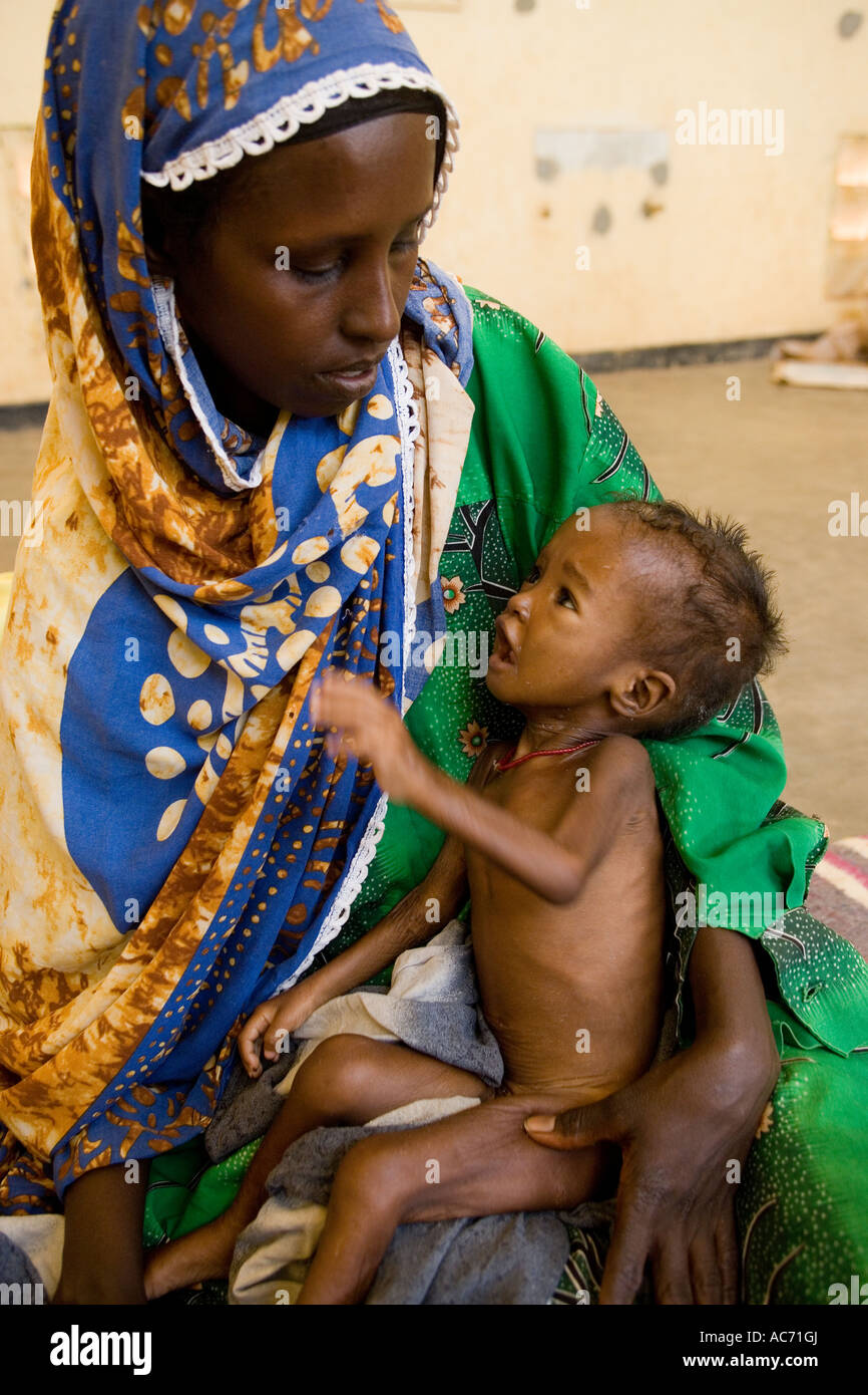 Seynab Abey holds severely malnourished daughter Fatuma Hared 18 months Fatuma is also suffering from TB Stock Photo