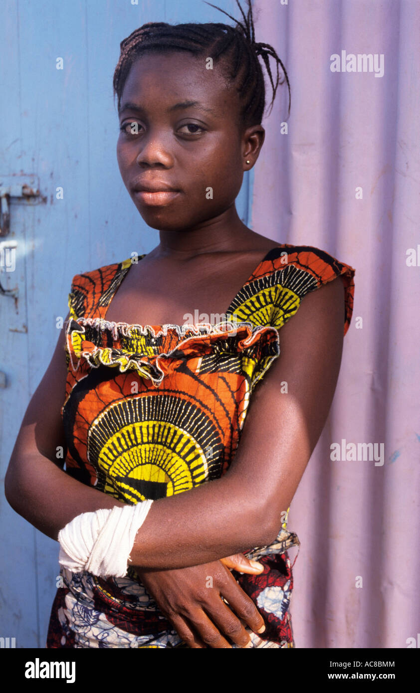 Africa Sierra Leone 1999 Victims of war Amputee camp for those whose limbs were maliciously hacked off during civil conflict Stock Photo