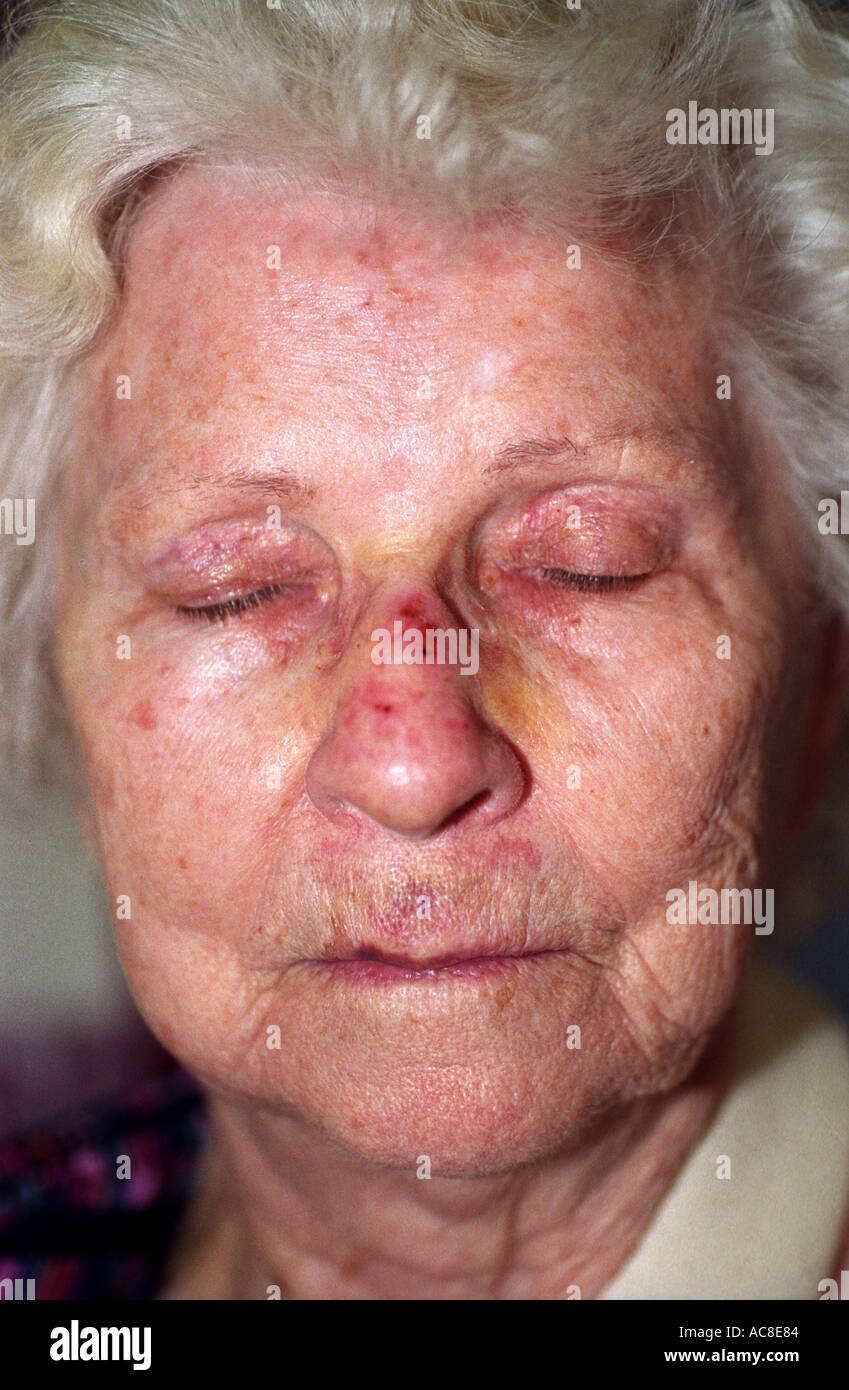 Older Woman With Bruised Face After Fall In Parking Lot 1551 Stock ...