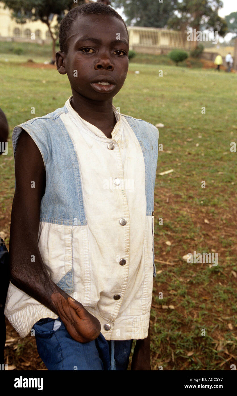 Glue sniffer with severe disability in park, Kampala, Uganda Stock Photo