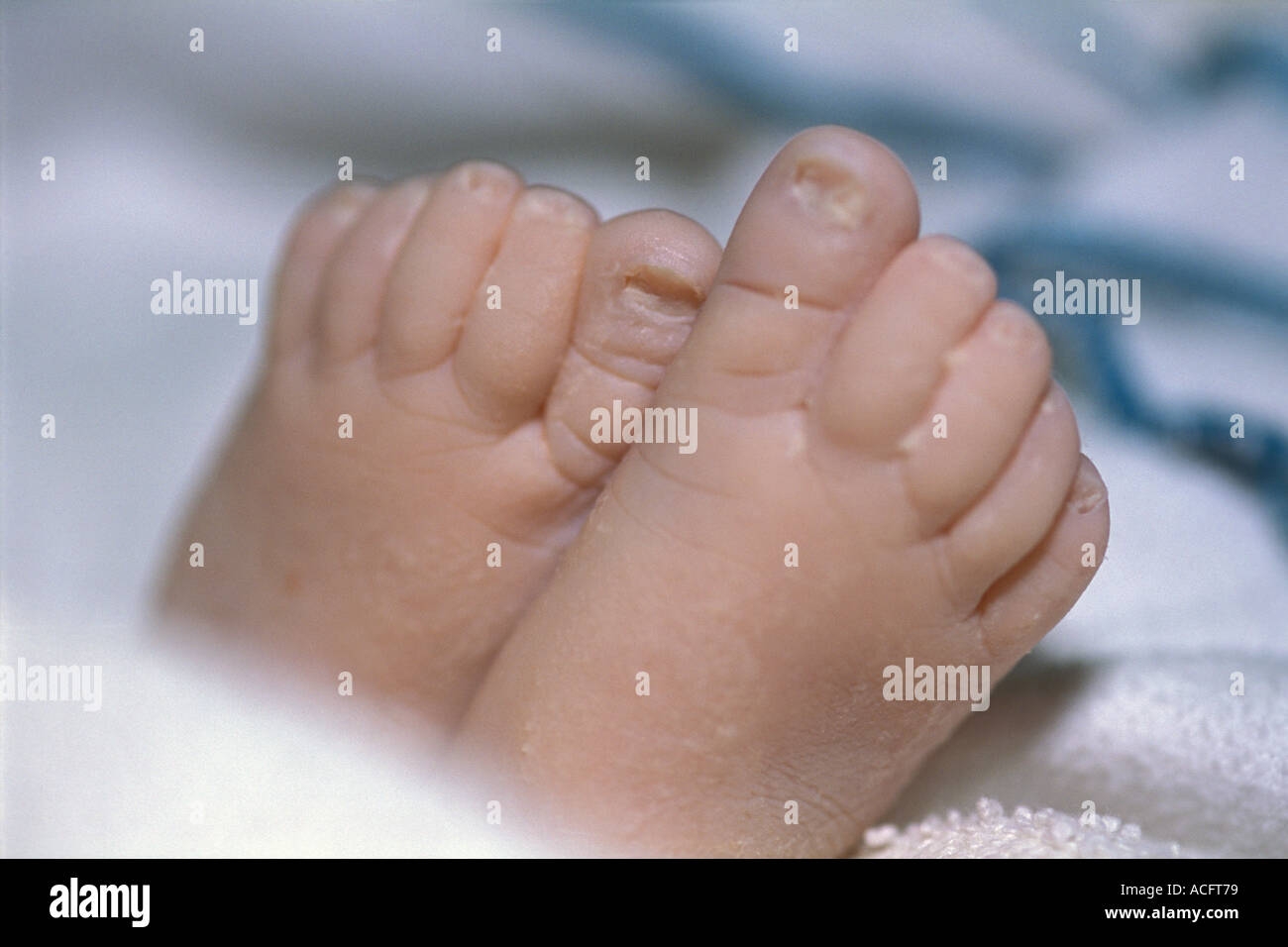 Newborn feet Stock Photo - Alamy
