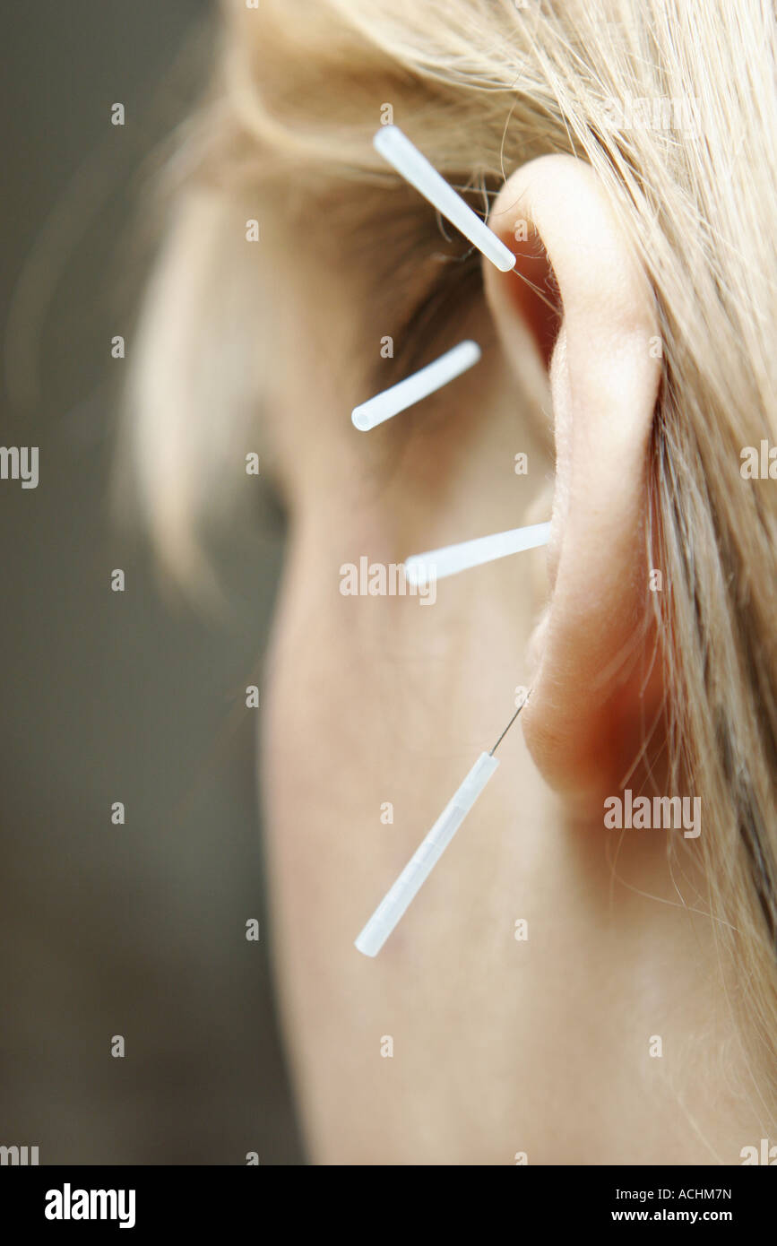Acupressure ear hires stock photography and images Alamy