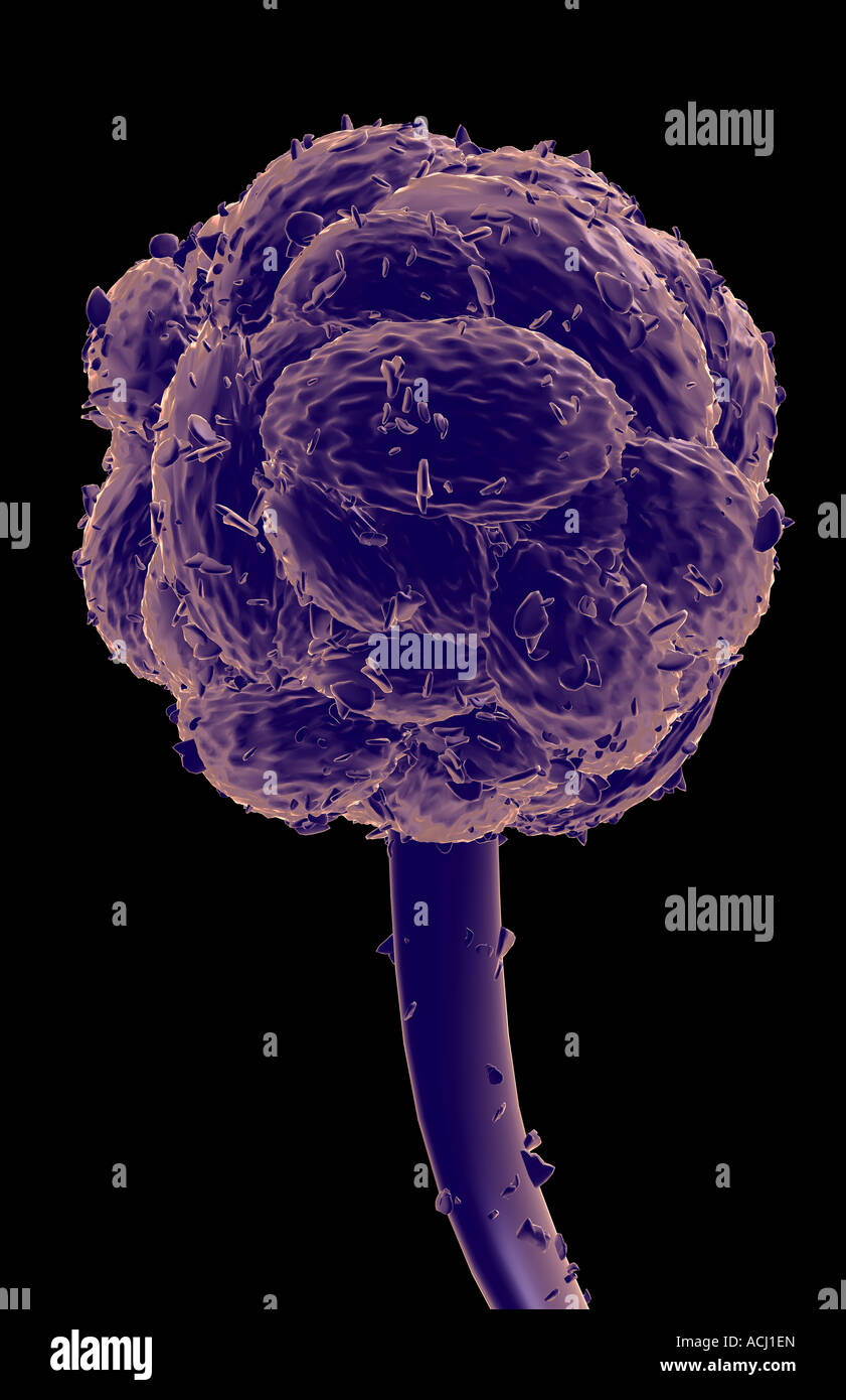 Stachybotrys Chartarum Stock Photo Alamy