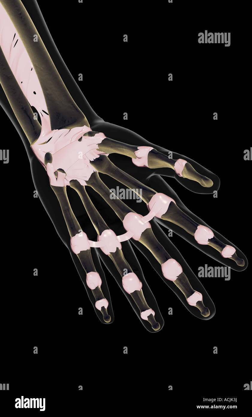 The ligaments of the hand Stock Photo