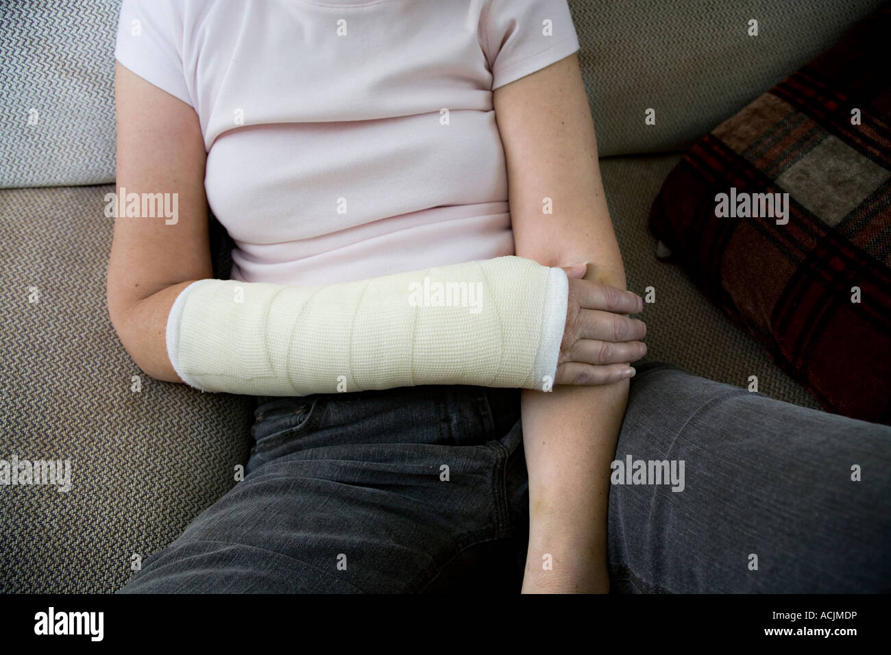 Plaster of paris cast arm hi-res stock photography and images - Alamy