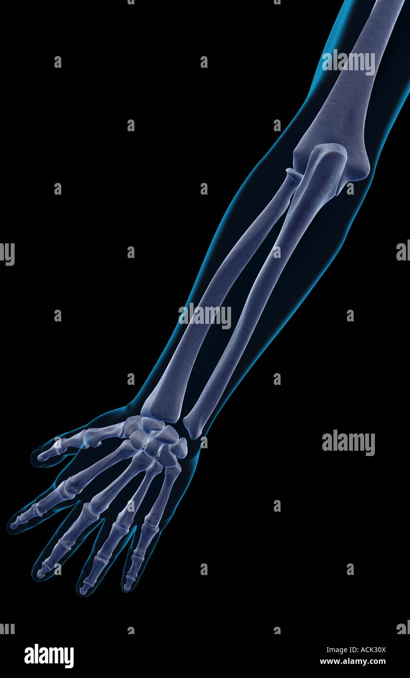 Forearm Bones High Resolution Stock Photography and Images - Alamy
