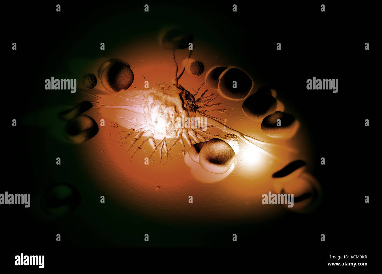Cancerous cells hi-res stock photography and images - Alamy