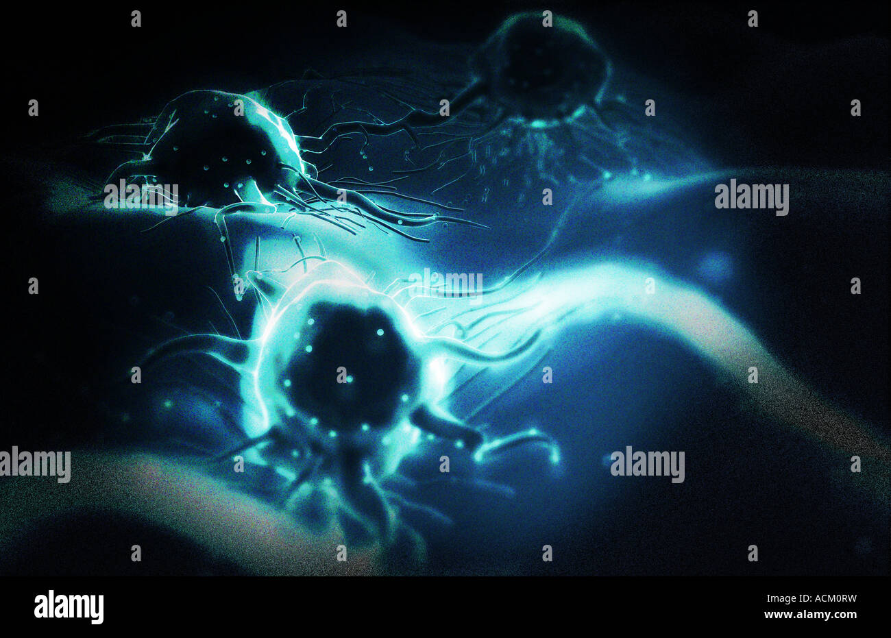 Cancer tumour hi-res stock photography and images - Alamy