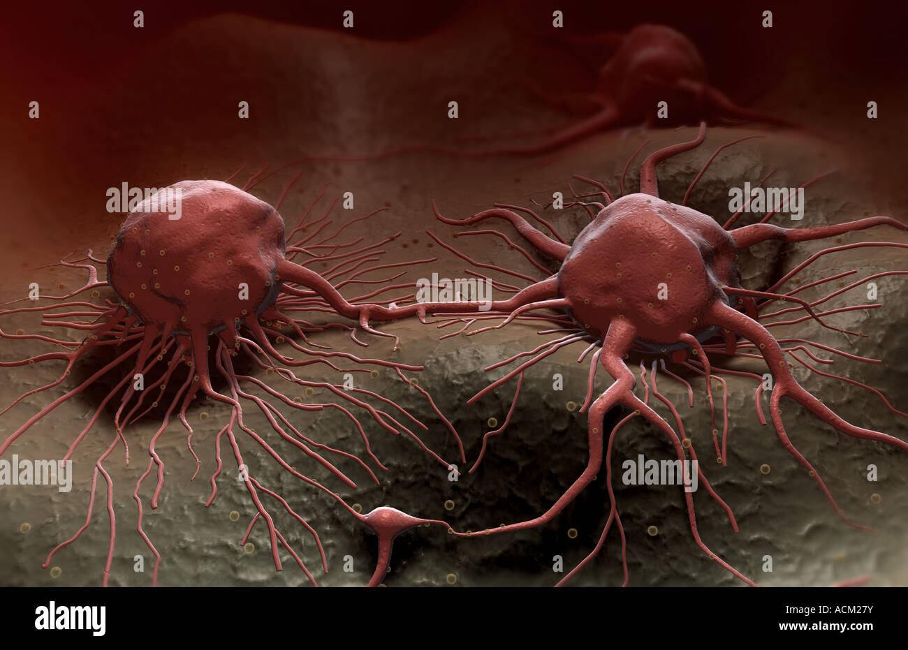 Tumour cells hi-res stock photography and images - Alamy