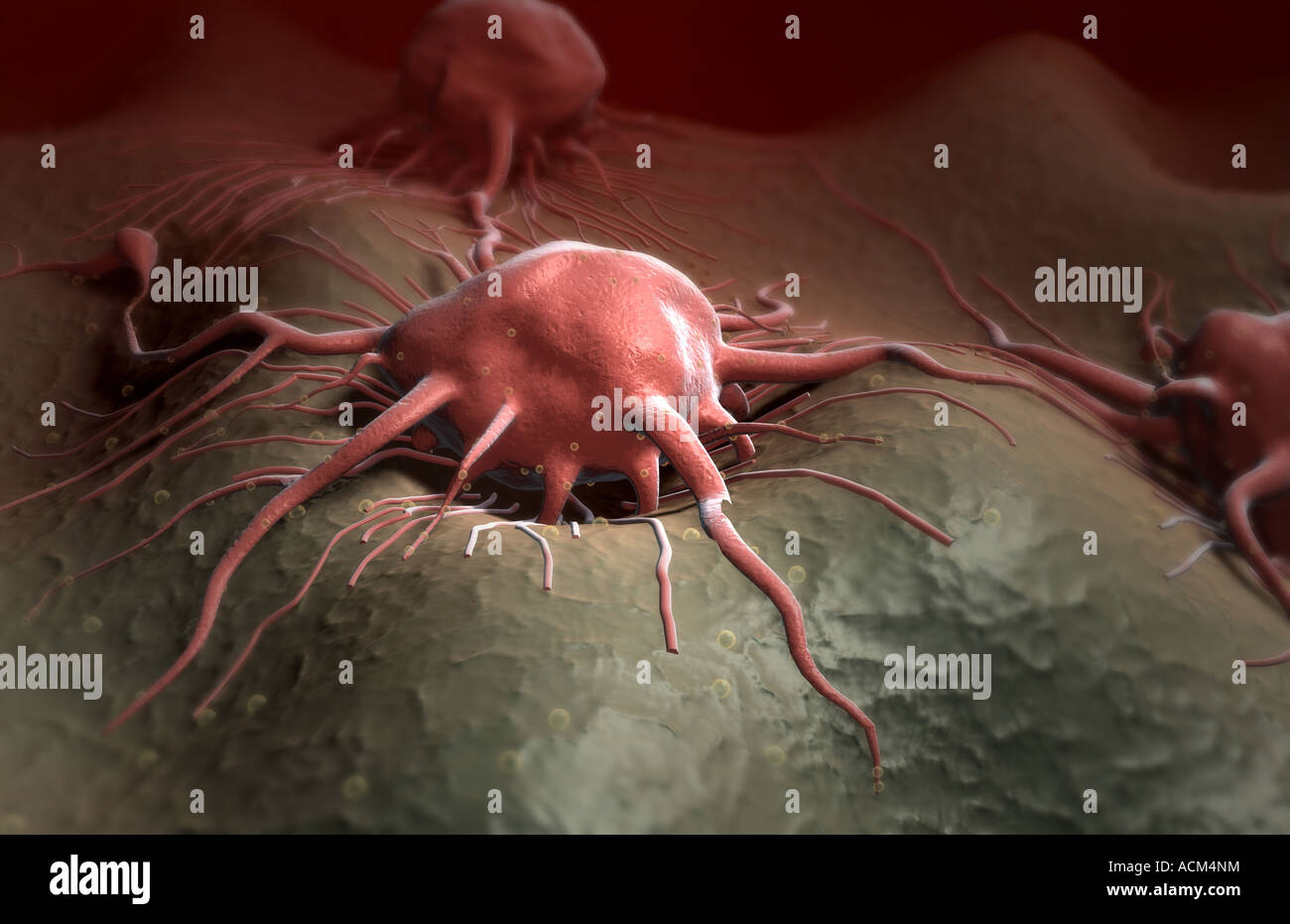 Tumour cells hi-res stock photography and images - Alamy
