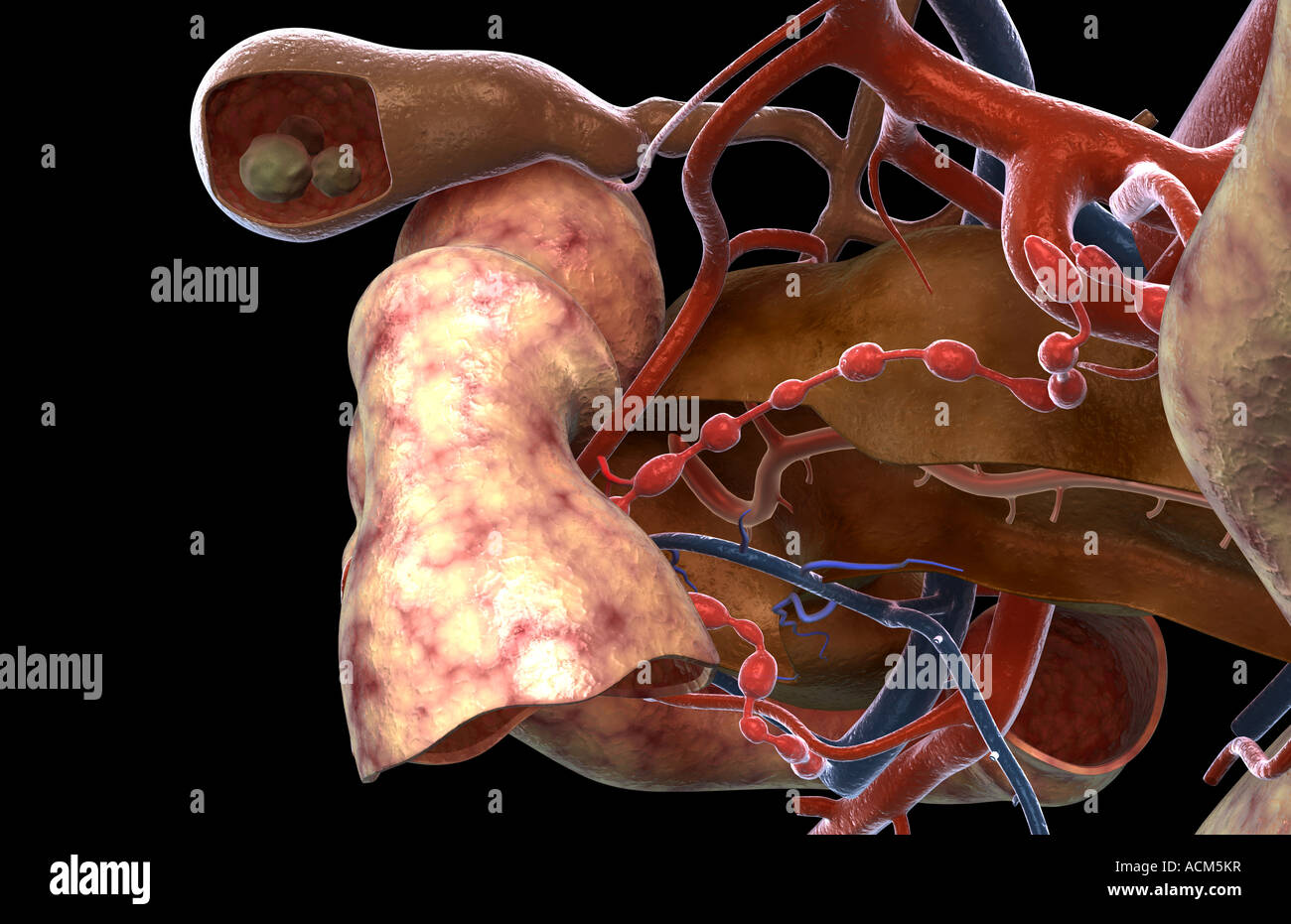 Cholelithiasis High Resolution Stock Photography and Images Alamy