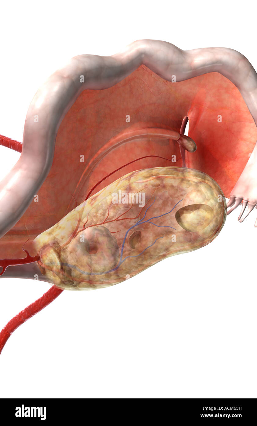 Ligament of ovary hi-res stock photography and images - Alamy