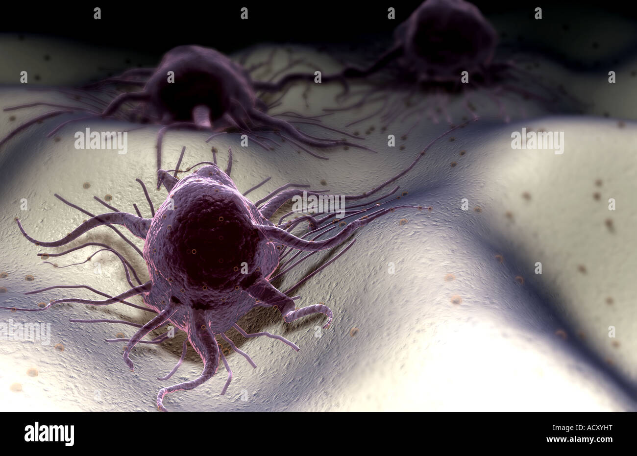 Tumour cells hi-res stock photography and images - Alamy