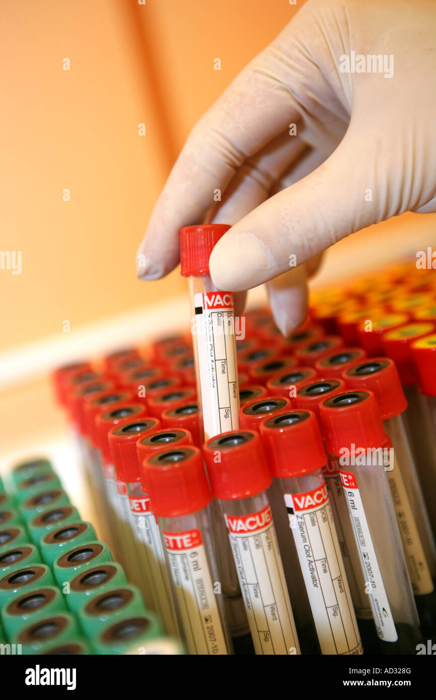 Medical blood test tubes equipment hires stock photography and images