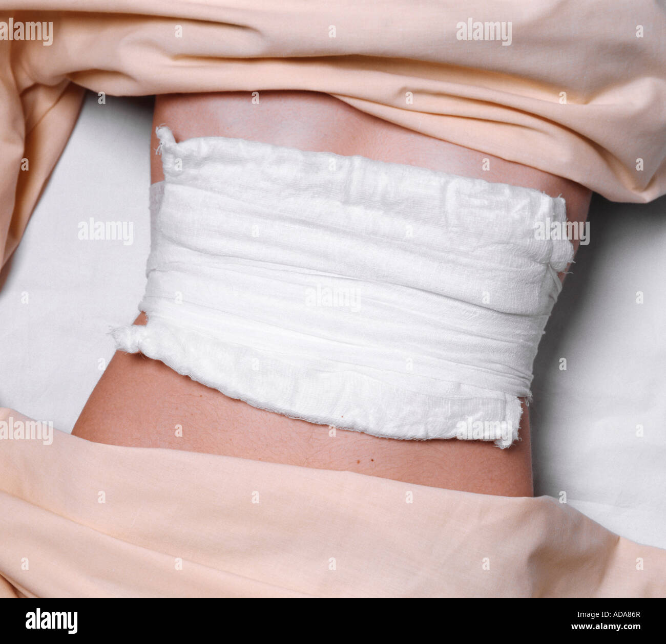 Close up of abdominal bandage Stock Photo Alamy