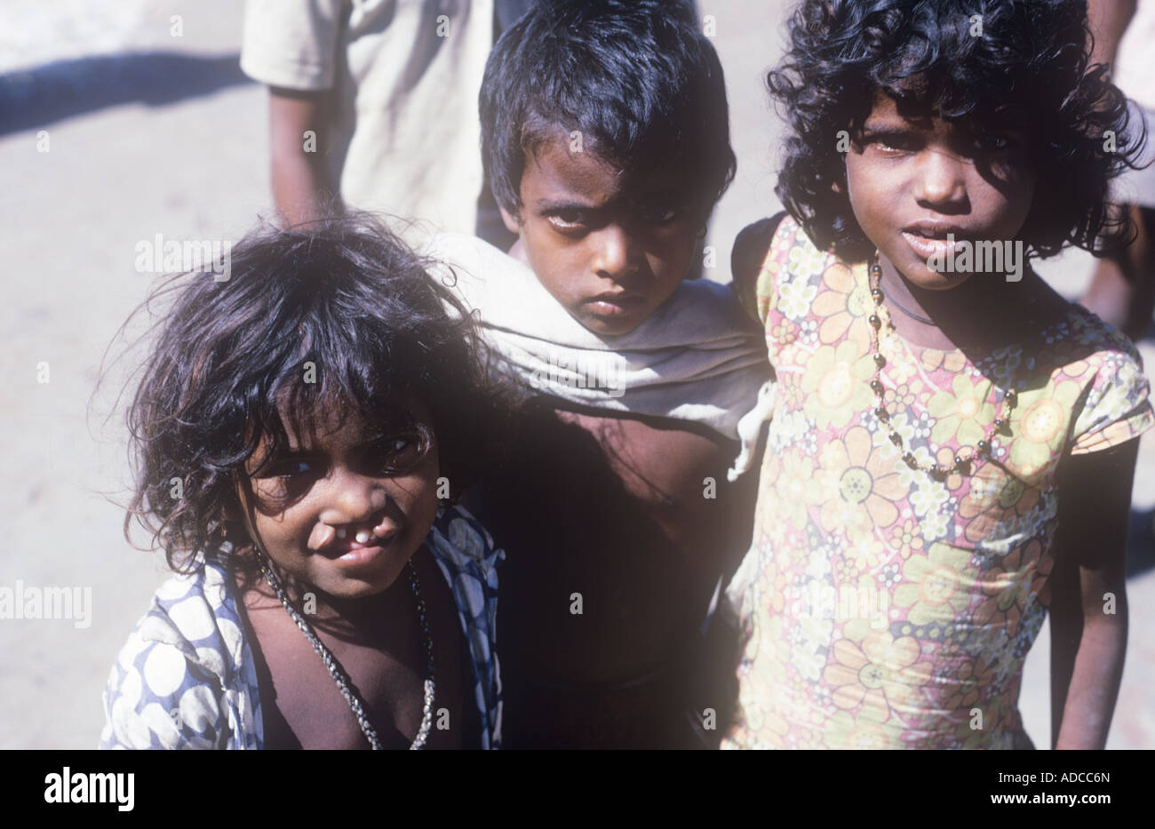 Girl with hair lip, or cleft palate, and other street children in Mumbai India Stock Photo