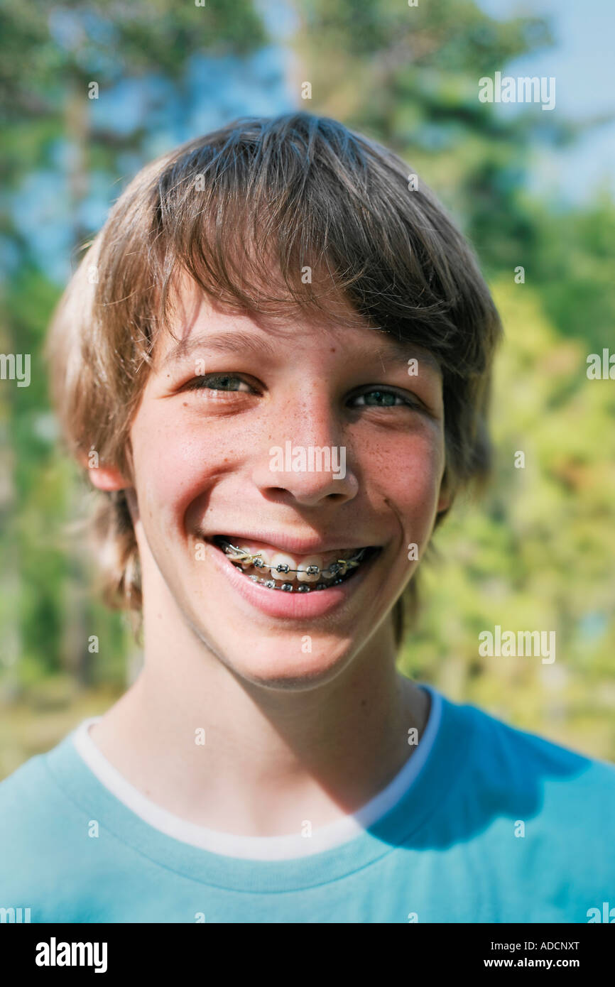 BOY WITH BRACES 12 YEARS OLD Stock Photo Alamy